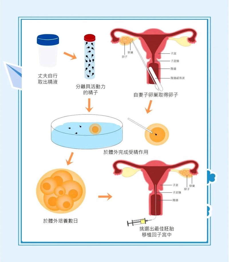 试管婴儿:解决生育难题的科学之路